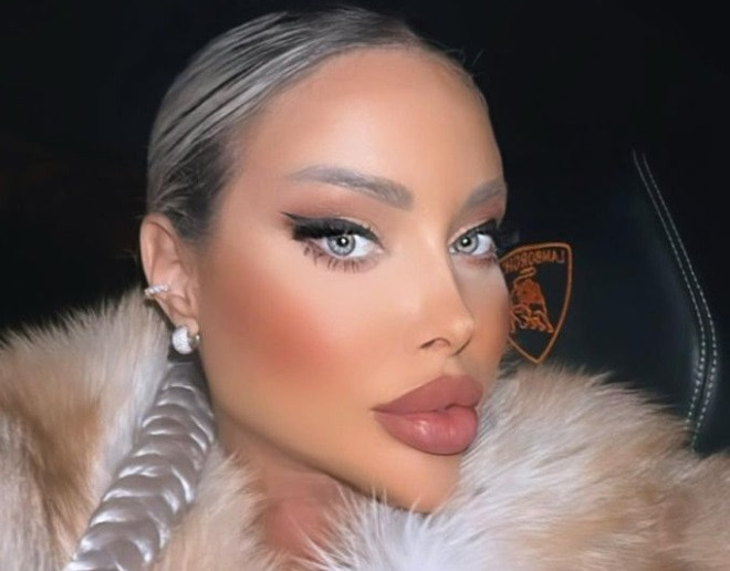 Loredana Chivu, bătută și amenințată cu moartea de logodnicul ei: „A trebuit să ies cu poliția din hotel”