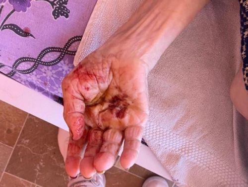 Controalele din azile s-au terminat. Bilanțul: 100 de centre închise, audieri și zeci de amenzi