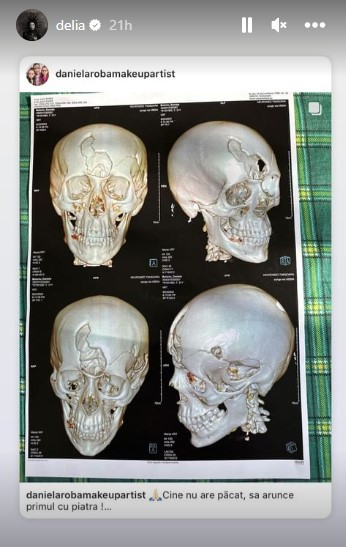 Delia a sărit în apărarea Danei Roba. Reacția dură a artistei, după ce a citit mai multe comentarii răutăcioase: „Ce oameni sunteți?”