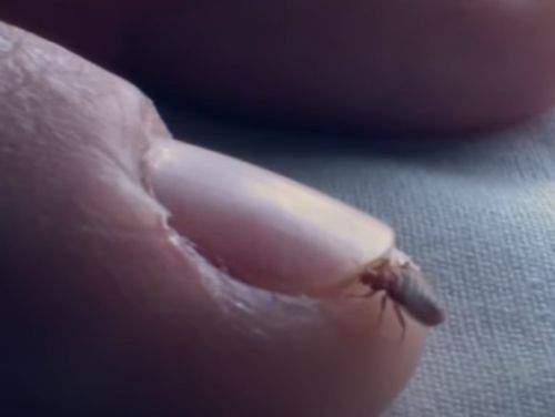 Bucureștiul, invadat de ploșnițe. Cât te costă să scapi de ele