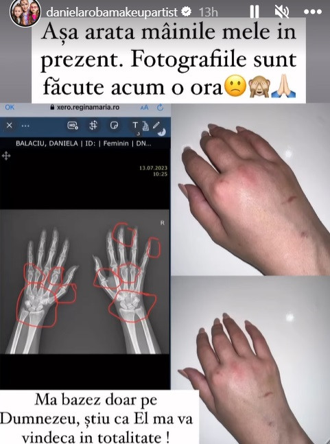 Dana Roba, imagini înduioșătoare pe Instagram. Cum arată mâinile sale: „Am plâns mai mult ca niciodată”