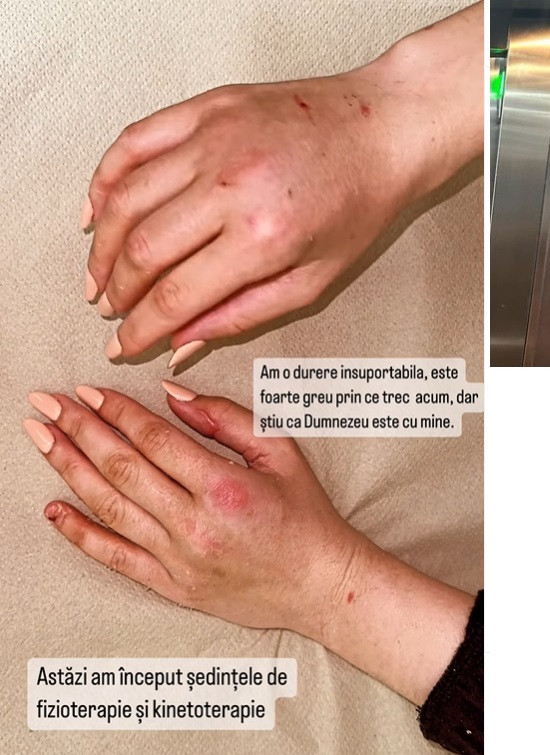 Dana Roba, imagini înduioșătoare pe Instagram. Cum arată mâinile sale: „Am plâns mai mult ca niciodată”